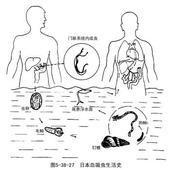 間插血吸蟲病 間插血吸蟲病