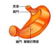 賁門癌 賁門癌