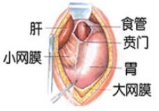 賁門失馳癥 賁門失馳癥