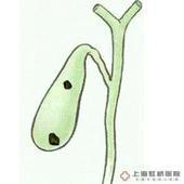 陶瓷樣膽囊 陶瓷樣膽囊