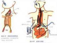 強堿類中毒 強堿類中毒