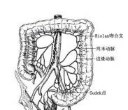 缺血性結(jié)腸炎 缺血性結(jié)腸炎