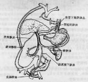 尼曼-皮克病 尼曼-皮克病