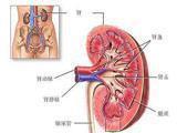 小兒狼瘡腎炎 小兒狼瘡腎炎