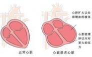 新生兒低鎂血癥 新生兒低鎂血癥