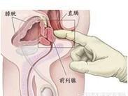 泌尿生殖系損傷
