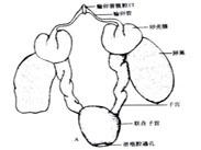 月經不調