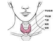 慢性纖維性甲狀腺炎
