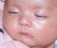 新生兒反應低下 新生兒反應低下