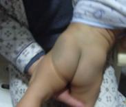 血小板減少癥 血小板減少癥