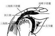 肩峰下滑囊炎 肩峰下滑囊炎