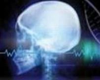 神經轉移性腫瘤 神經轉移性腫瘤