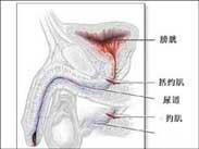 陰莖結核 陰莖結核