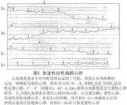 房性逸搏和房性逸搏心律